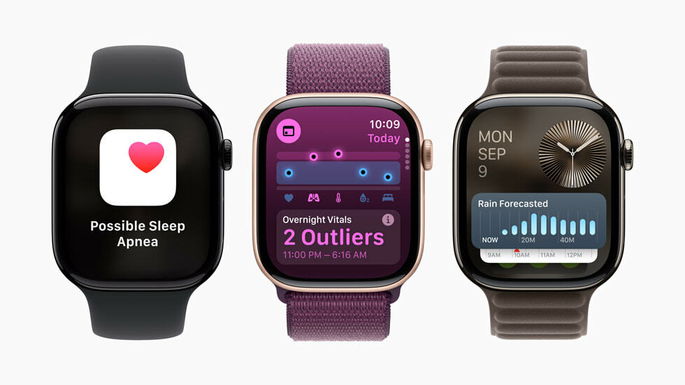 Apple Watch Vitals