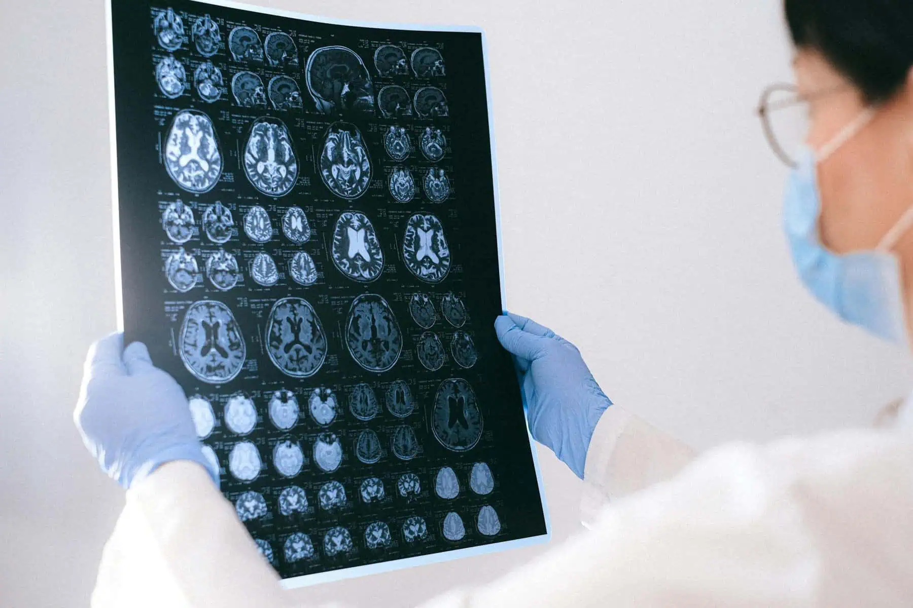 Conexión de descubrimiento entre el mentol y la enfermedad de Alzheimer