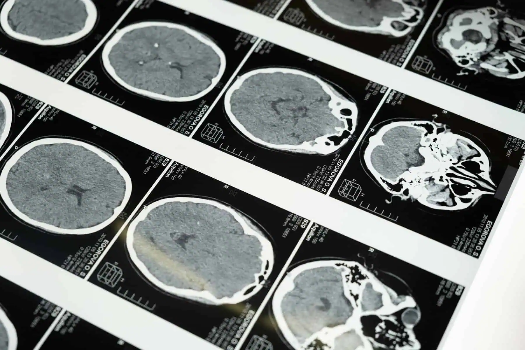 cerebro guardar recuerdos, cerebro envejecido
