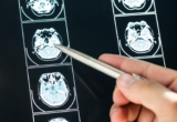 La inteligencia artificial pronto podría sustituir a los radiólogos
